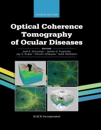 Cover image: Optical Coherence Tomography of Ocular Diseases 4th edition 9781630917081