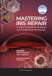 Cover image: Mastering Iris Repair 9781630917289