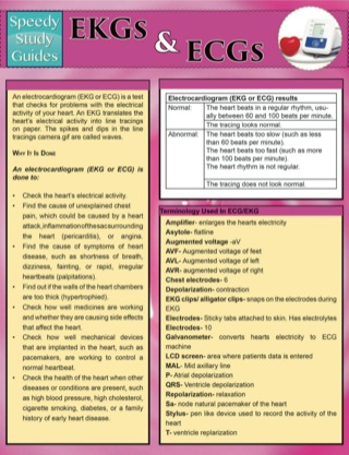 Cover image: Ekgs And Ecgs (Speedy Study Guides) 9781633839069