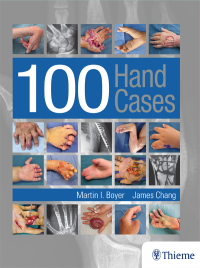 Cover image: 100 Hand Cases 1st edition 9781626236608