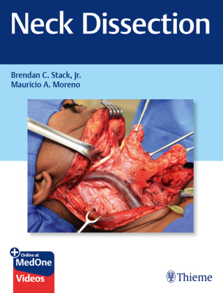Cover image: Neck Dissection 1st edition 9781626238343