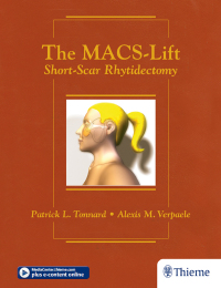 Cover image: The MACS-Lift 1st edition 9781626236332