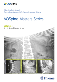 Cover image: AOSpine Masters Series, Volume 4: Adult Spinal Deformities 1st edition 9781626231009