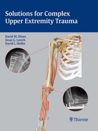 Cover image: Solutions for Complex Upper Extremity Trauma 1st edition 9781588905048