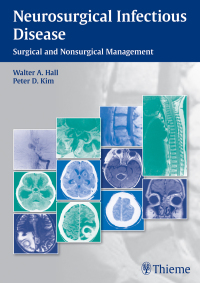 Omslagafbeelding: Neurosurgical Infectious Disease 1st edition 9781604068054