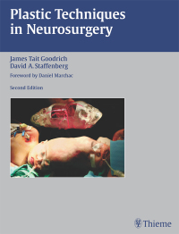 Titelbild: Plastic Techniques in Neurosurgery 2nd edition 9781588902719
