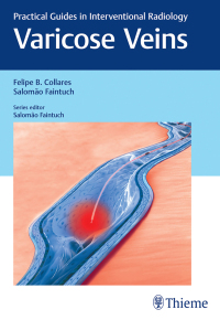 Cover image: Varicose Veins 1st edition 9781626230125