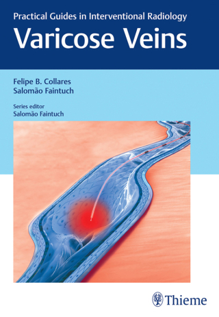 Cover image: Varicose Veins 1st edition 9781626230125