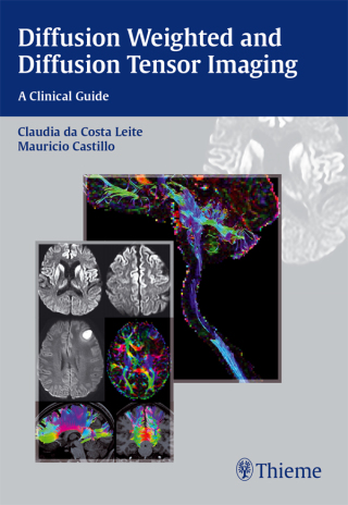Cover image: Diffusion Weighted and Diffusion Tensor Imaging 1st edition 9781626230217