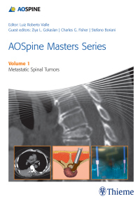 表紙画像: AOSpine Masters Series, Volume 1: Metastatic Spinal Tumors 1st edition 9781626230460