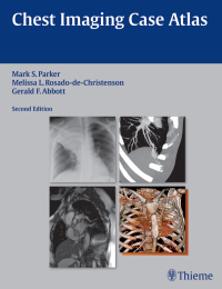 Imagen de portada: Chest Imaging Case Atlas 2nd edition 9781604065909