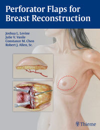 Imagen de portada: Perforator Flaps for Breast Reconstruction 1st edition 9781626230941