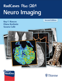 Cover image: RadCases Plus Q&A Neuro Imaging 2nd edition 9781626232372