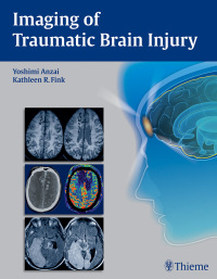 Cover image: Imaging of Traumatic Brain Injury 1st edition 9781604067286