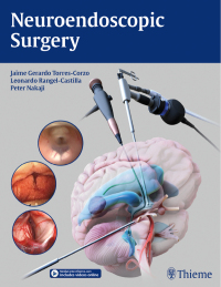 Cover image: Neuroendoscopic Surgery 1st edition 9781684202218