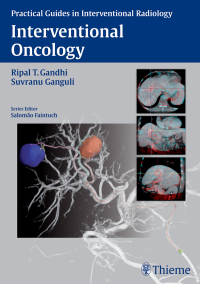 Cover image: Interventional Oncology 1st edition 9781626230811