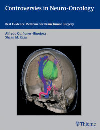 Cover image: Controversies in Neuro-Oncology 1st edition 9781604067552