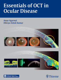 Cover image: Essentials of OCT in Ocular Disease 1st edition 9781626230989