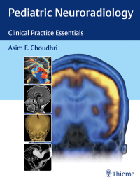 Cover image: Pediatric Neuroradiology 1st edition 9781626230965