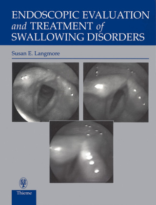 表紙画像: Endoscopic Evaluation and Treatment of Swallowing Disorders 2nd edition 9780865778382