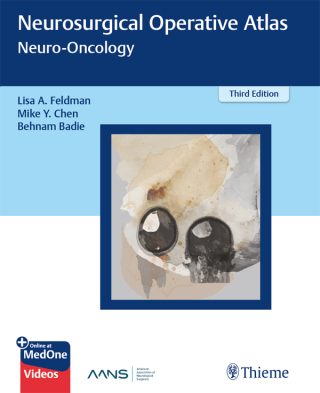Cover image: Neurosurgical Operative Atlas: Neuro-Oncology 3rd edition 9781626231085