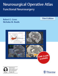 Cover image: Neurosurgical Operative Atlas 3rd edition 9781626231115