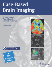 Titelbild: Case-Based Brain Imaging 2nd edition 9781604069532
