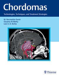 Cover image: Chordomas 1st edition 9781626231597