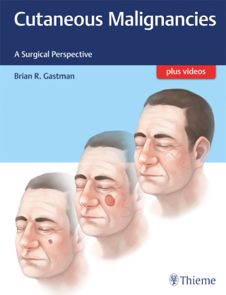 Cover image: Cutaneous Malignancies 1st edition 9781626231474