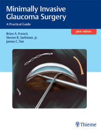 Omslagafbeelding: Minimally Invasive Glaucoma Surgery 1st edition 9781626231566