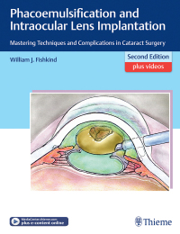 Titelbild: Phacoemulsification and Intraocular Lens Implantation 2nd edition 9781626231290