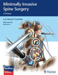 Cover image: Minimally Invasive Spine Surgery 1st edition 9781626232181