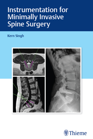 Imagen de portada: Instrumentation for Minimally Invasive Spine Surgery 1st edition 9781626232020