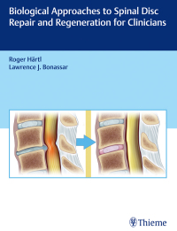 Imagen de portada: Biological Approaches to Spinal Disc Repair and Regeneration for Clinicians 1st edition 9781626232501