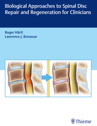 表紙画像: Biological Approaches to Spinal Disc Repair and Regeneration for Clinicians 1st edition 9781626232501