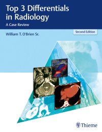 Omslagafbeelding: Top 3 Differentials in Radiology 2nd edition 9781626232785