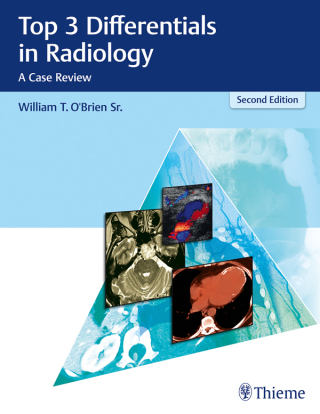 Cover image: Top 3 Differentials in Radiology 2nd edition 9781626232785