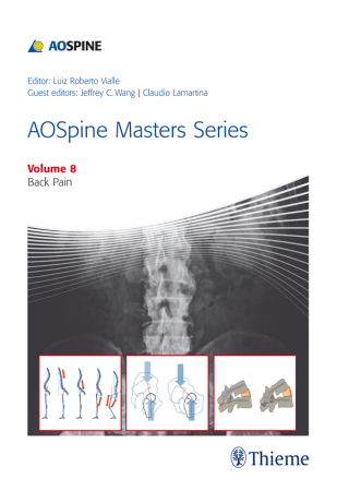 Cover image: AOSpine Masters Series, Volume 8: Back Pain 1st edition 9781626232297