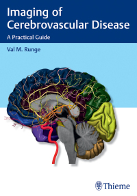صورة الغلاف: Imaging of Cerebrovascular Disease 1st edition 9781626232488