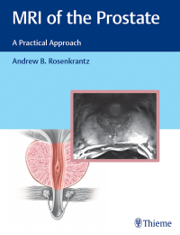 Imagen de portada: MRI of the Prostate 1st edition 9781626232686