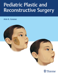 Omslagafbeelding: Pediatric Plastic and Reconstructive Surgery 1st edition 9781626232624