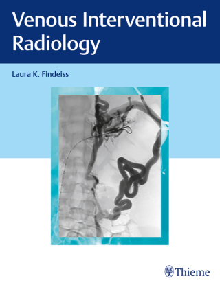 Titelbild: Venous Interventional Radiology 1st edition 9781626232730