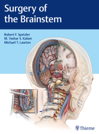 Cover image: Surgery of the Brainstem 1st edition 9781626232914