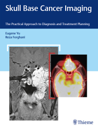Titelbild: Skull Base Cancer Imaging 1st edition 9781626232969