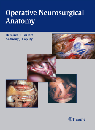 Cover image: Operative Neurosurgical Anatomy 1st edition 9781588900661