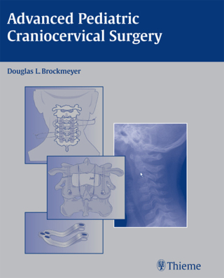 Omslagafbeelding: Advanced Pediatric Craniocervical Surgery 1st edition 9781588903969