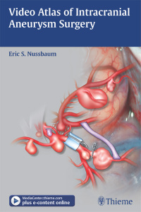 Cover image: Video Atlas of Intracranial Aneurysm Surgery 1st edition 9781604067385