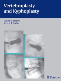 Cover image: Vertebroplasty and Kyphoplasty 1st edition 9781588902276