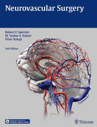 Cover image: Neurovascular Surgery 2nd edition 9781604067590