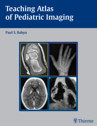 Cover image: Teaching Atlas of Pediatric Imaging 1st edition 9781588903396